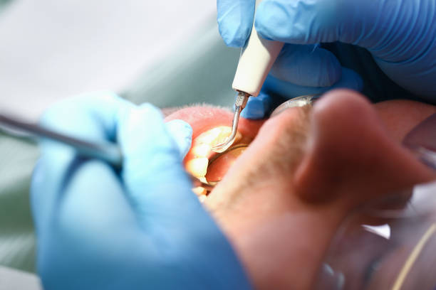 Professional Emergency Dental Service in MD